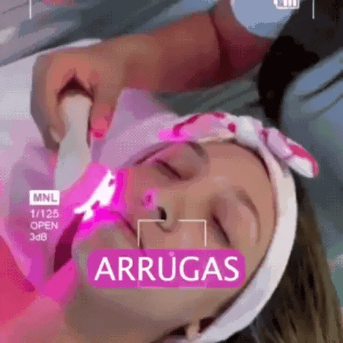 Skinglow prop radiofrecuencia